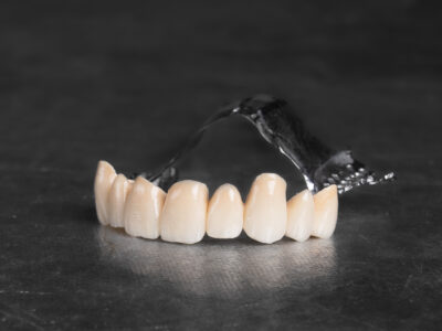 Attachment denture