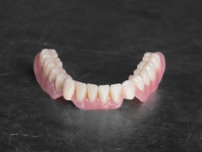 Lower telescopic denture